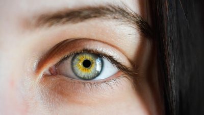 The Rarest Eye Colours in the World and What Makes Them Unique